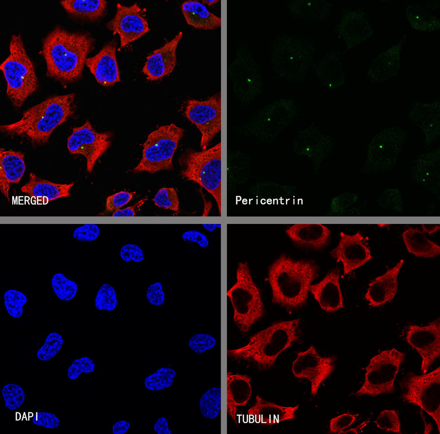 Pericentrin Recombinant Rabbit mAb (S-3515-69)