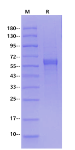 Furin/PCSK3 His Tag Protein, Human