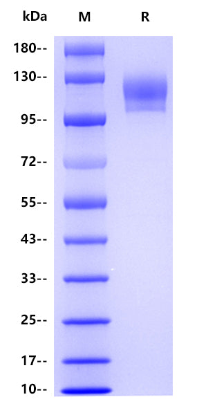 Human CD29 , His tag