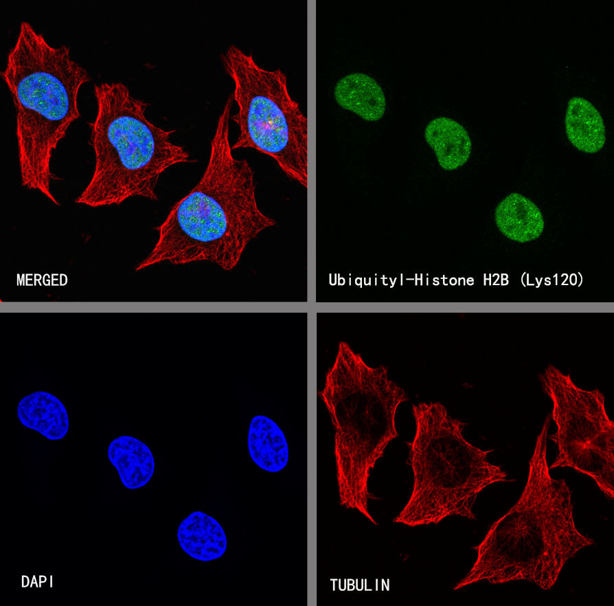 Ubiquityl-Histone H2B (Lys120) Recombinant Rabbit mAb (S-5698)