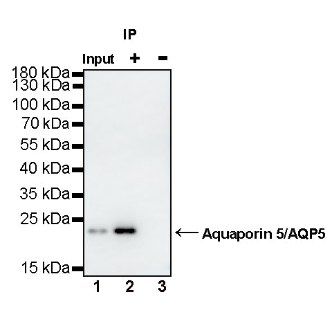 Aquaporin 5/AQP5 Recombinant Rabbit mAb (S-1610-43)