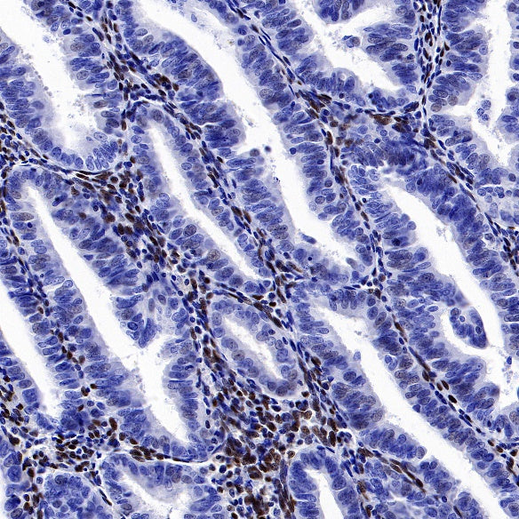 ZEB1 Recombinant Rabbit mAb