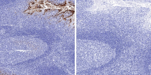 Goat Anti-Mouse IgG (H+L) (min X Hu, Bov Sr Prot)