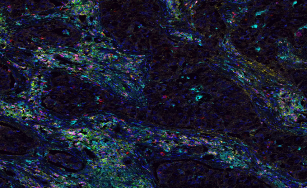 Absin 7-Color IHC Kit (Anti-Rabbit Secondary Antibody)