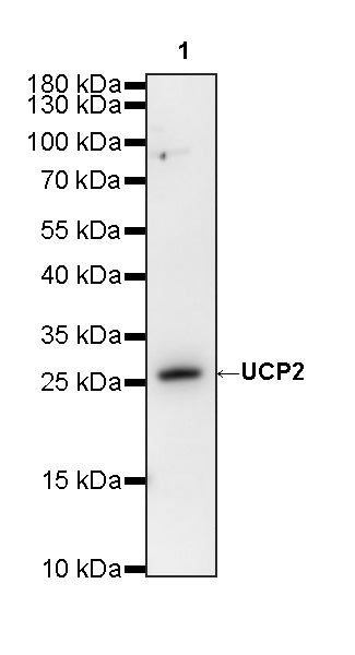 UCP2 Mouse mAb