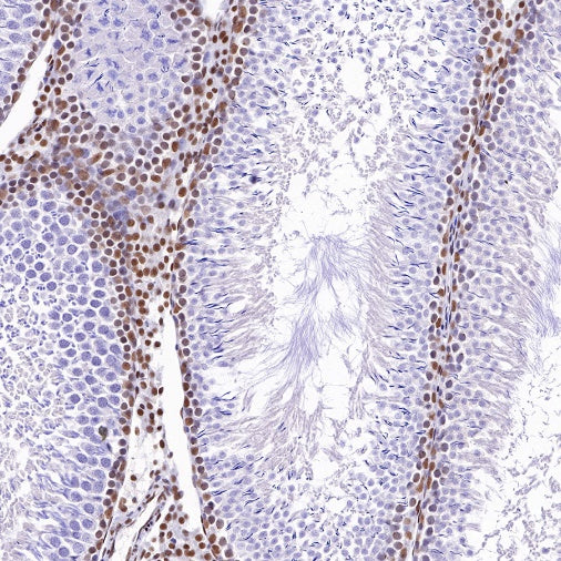 S-RMab® ATRX Recombinant Rabbit mAb (SDT-458-37)