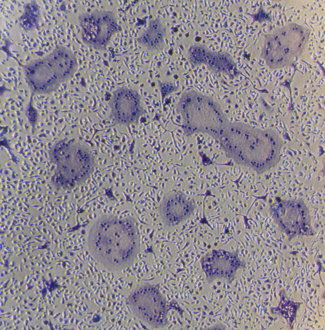 Mouse Bone Marrow-derived Macrophages (BMMs) Osteoclast Differentiation Cytokine Kit
