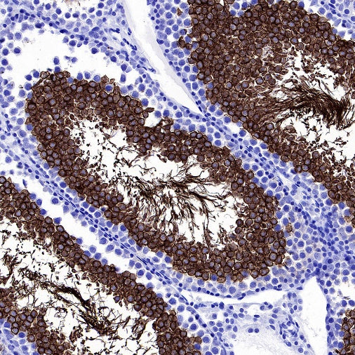 Hyaluronidase PH20/SPAM1 Recombinant Rabbit mAb (S-2143-20)
