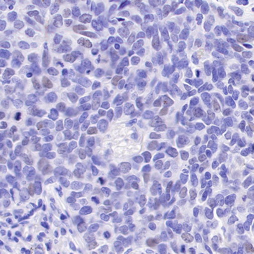 SAGE1 Recombinant Rabbit mAb (SDT-317-60)