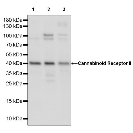 Cannabinoid Receptor II Recombinant Rabbit mAb (S-1775-134)