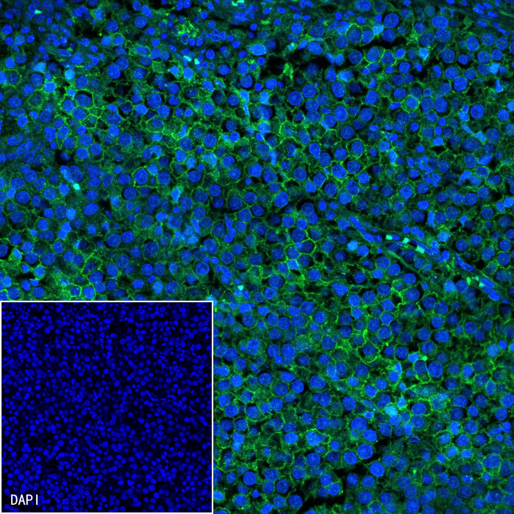 S-RMab® CD117 Recombinant Rabbit mAb (SDT-125-51)
