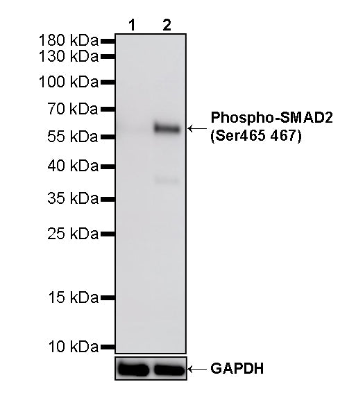Phospho-SMAD2 (Ser465/467) Recombinant Rabbit mAb (S-6222)