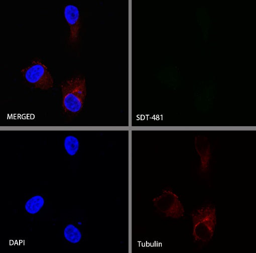 TFF1 Recombinant Rabbit mAb (S-481-16)