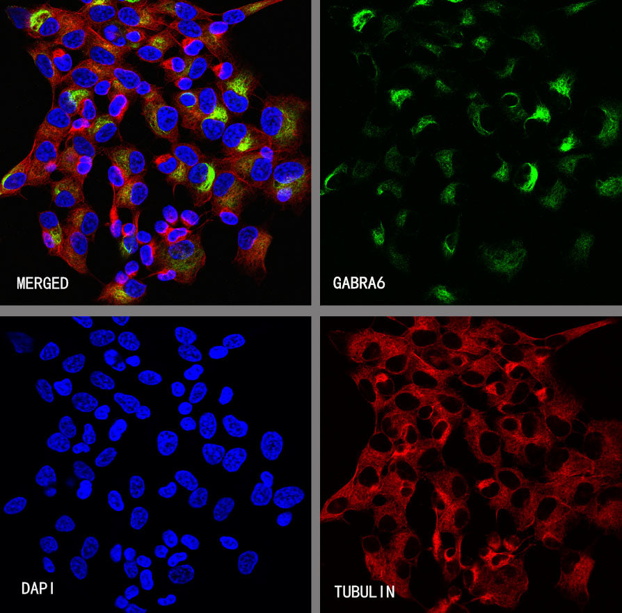 GABRA6 Recombinant Rabbit mAb (S-4855-23)