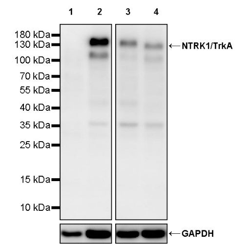 NTRK1/TrkA Recombinant Rabbit mAb (S-2524-16)