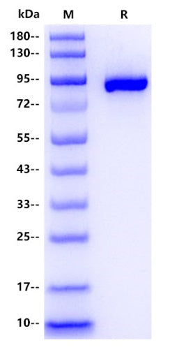 Mouse ECM1 Protein, His tag