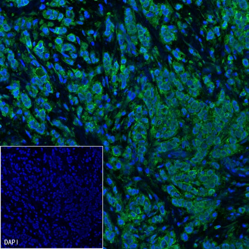ErbB2 Recombinant Rabbit mAb (Alexa Fluor® 488 Conjugate) (SDT-069-57)