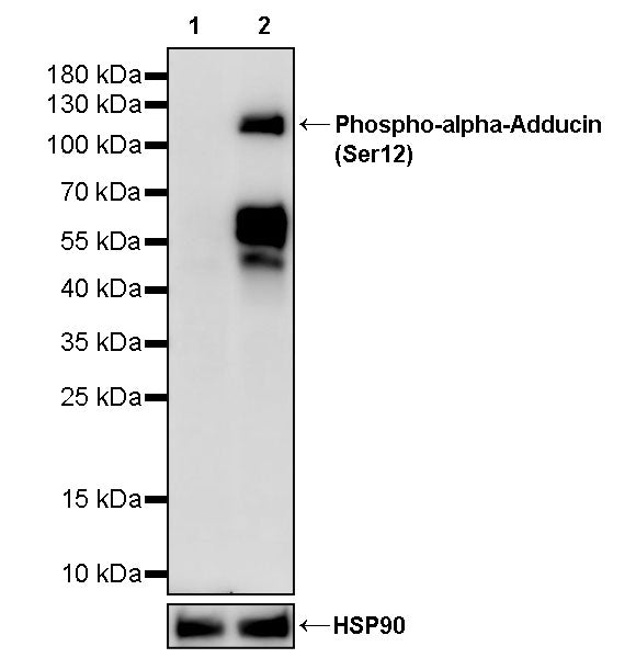 Phospho-alpha-Adducin (Ser12) Recombinant Rabbit mAb (S-4986)