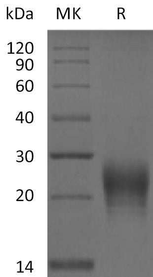 Fas Ligand/TNFSF6 Protein, Human