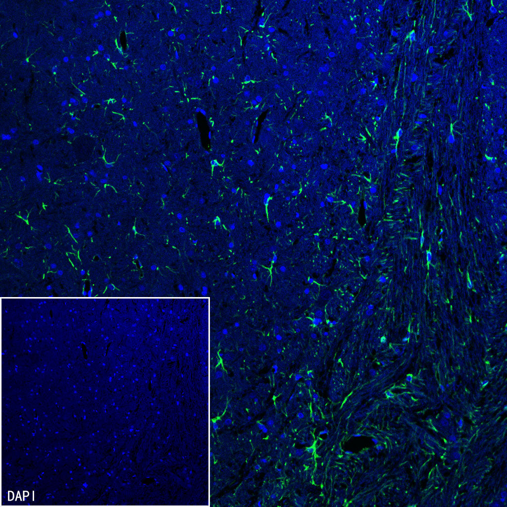 GFAP Recombinant Rabbit mAb (Alexa Fluor® 488 Conjugate) (SDT-306-10)