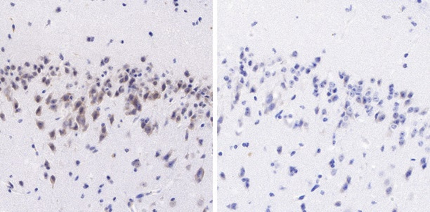 Tau (phospho S202+T205) Recombinant Mouse mAb (AT8)