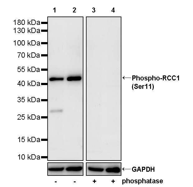 Phospho-RCC1 (Ser11) Recombinant Rabbit mAb (S-4988)