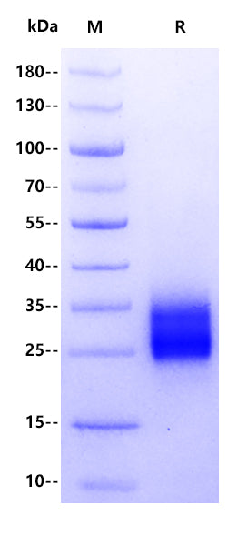 Human ECP/Ribonuclease 3 Protein, His Tag