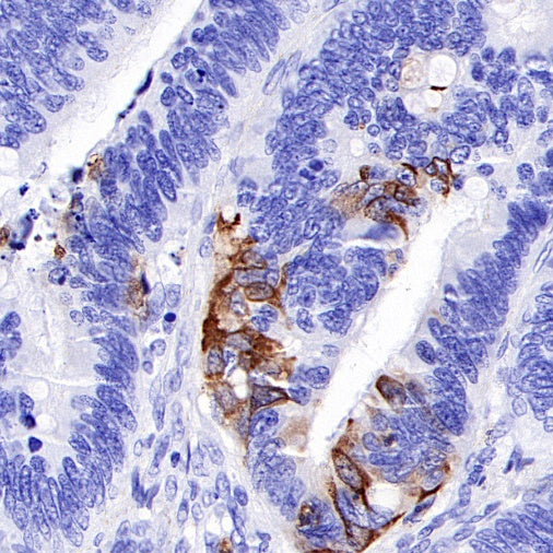 TFF1 Recombinant Rabbit mAb (S-336-75)