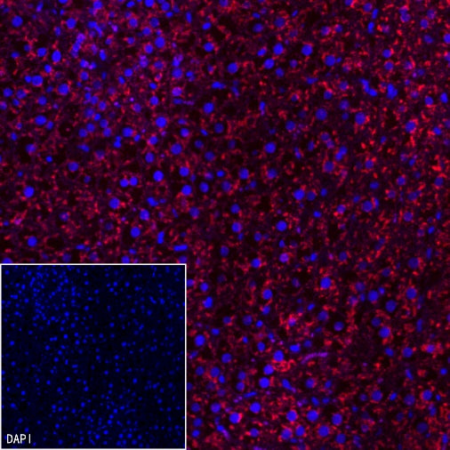 AMACR/p504s Recombinant Rabbit mAb (Alexa Fluor® 555 Conjugate) (SDT-401-29)
