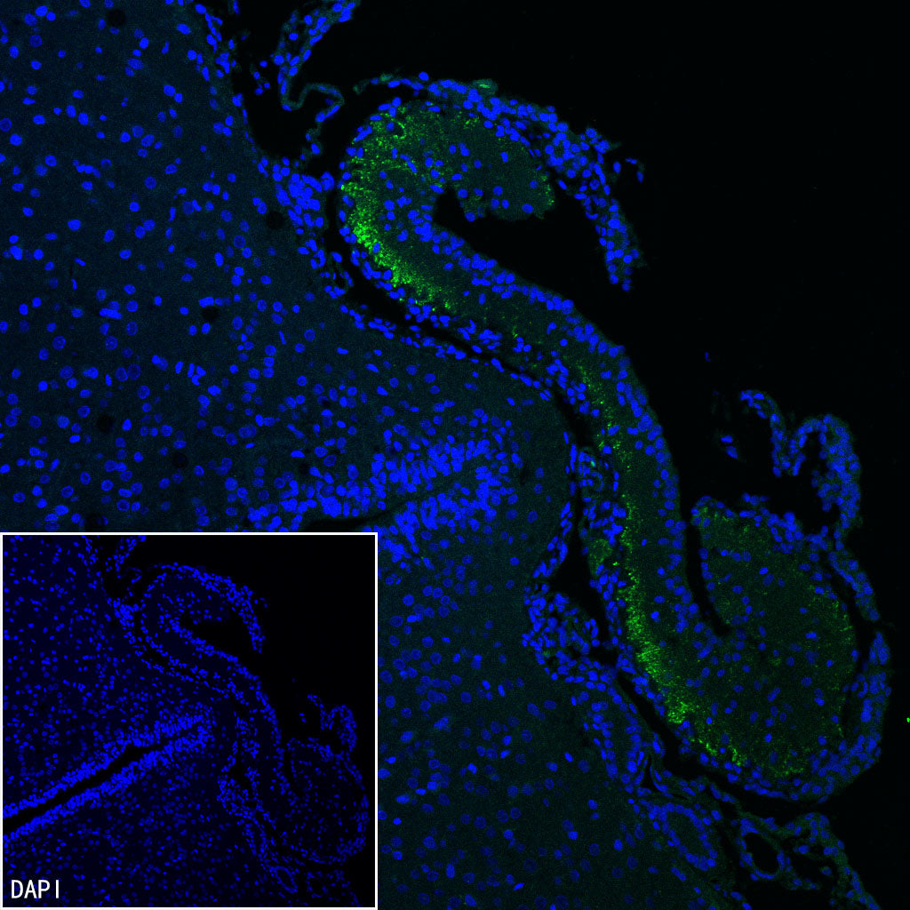 CRF Recombinant Rabbit mAb (S-5356)