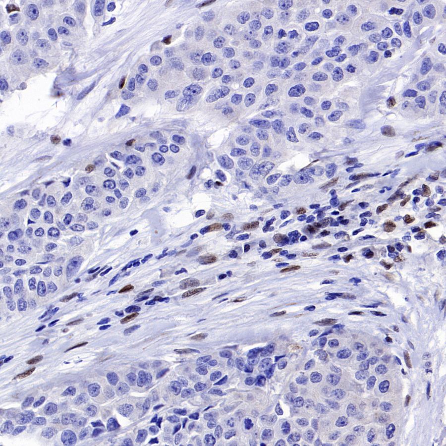 SLFN11 Recombinant Mouse mAb (S-1565-283)