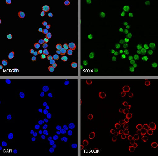 SOX4 Recombinant Rabbit mAb (S-2207-103)
