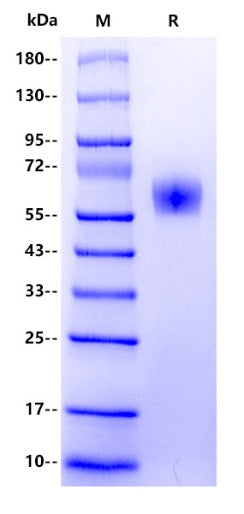 Human Factor H/CFH (860-1231aa) Protein, His Tag