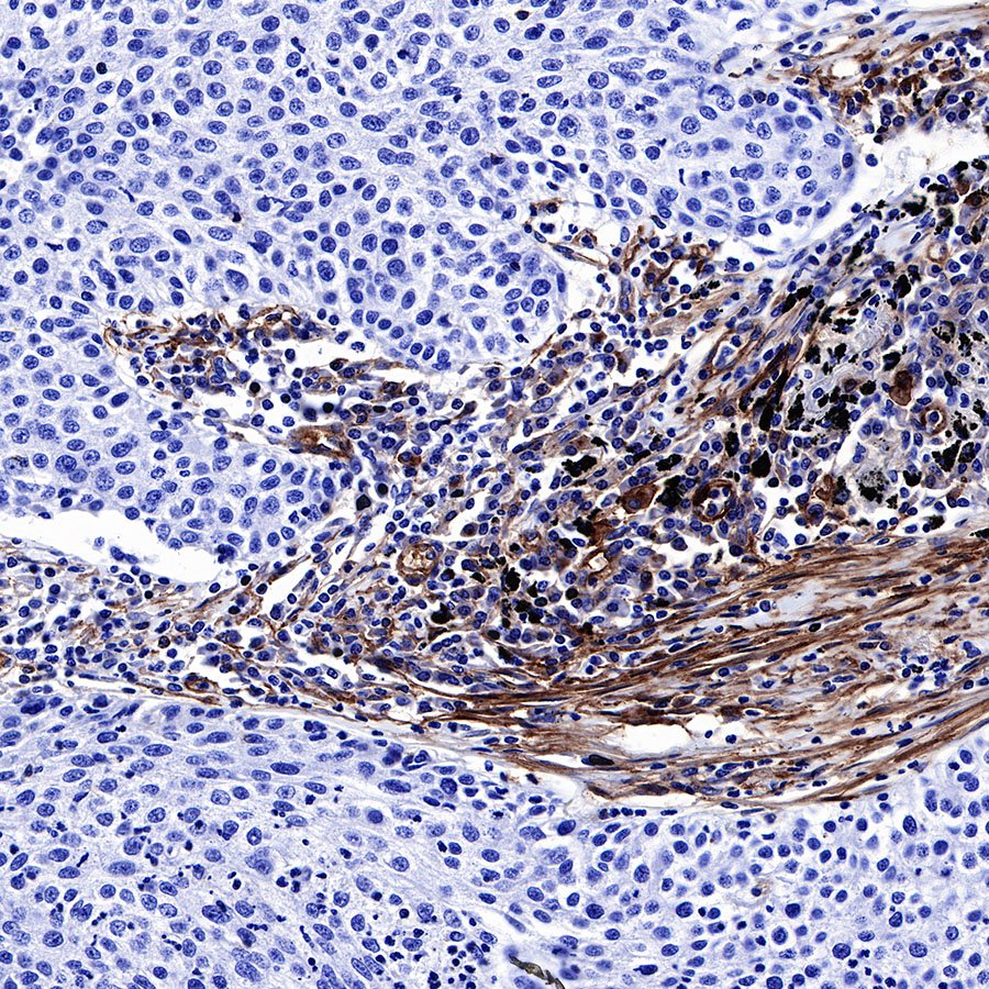 CD39 Recombinant Rabbit mAb (SDT-236-20)