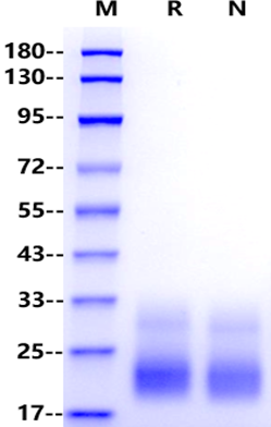 TIGIT His Tag Protein, Cynomolgus