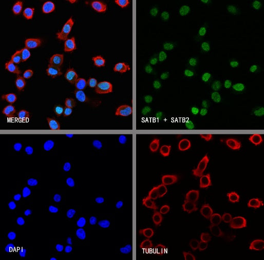SATB1 + SATB2 Recombinant Mouse mAb (S-3382)
