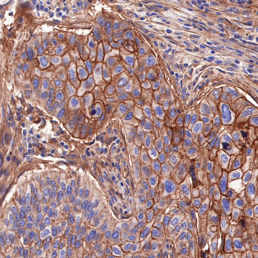 CD155/PVR Recombinant Rabbit mAb (SDT-289-68)