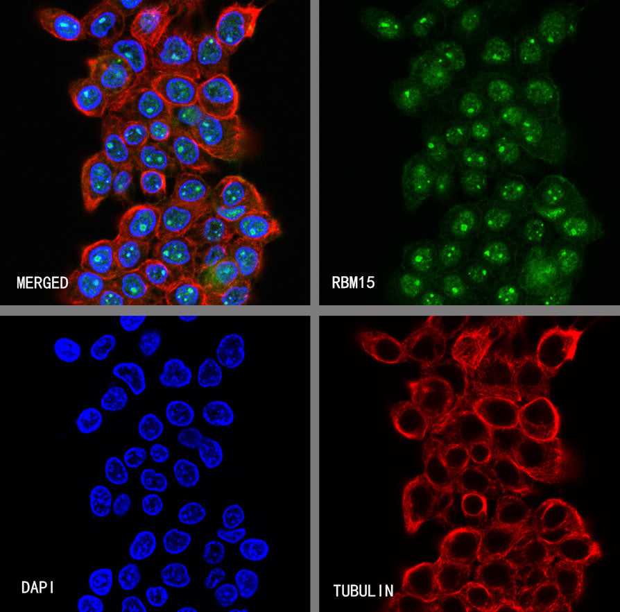 RBM15 Rabbit Polyclonal Antibody