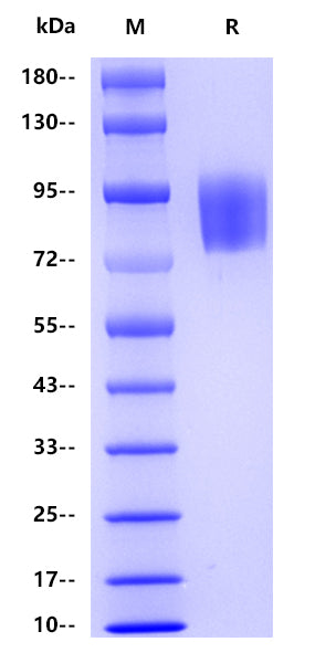 Human CD117 , His tag
