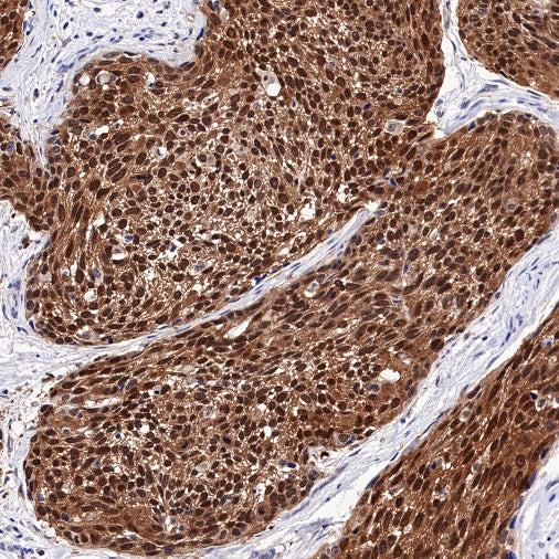 MCM6 Recombinant Rabbit mAb (S-899-23)