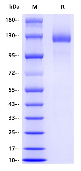 Human CD21, His tag