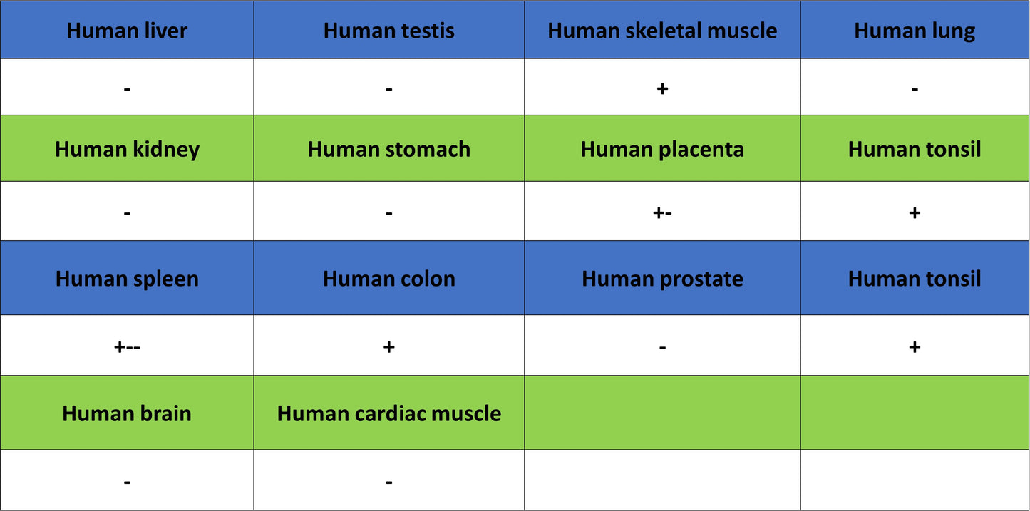 Thymidine Kinase 1 Recombinant Rabbit mAb (S-4127-43)