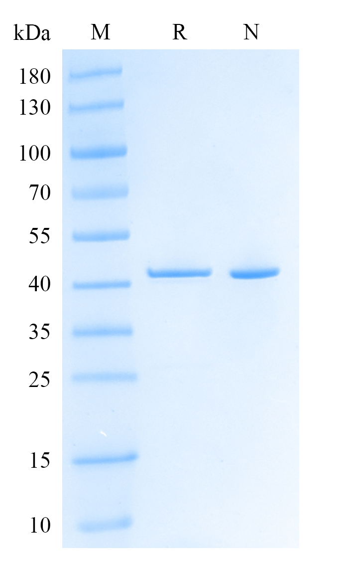 HRSV(Strain A2)Nucleoprotein,His Tag Protein