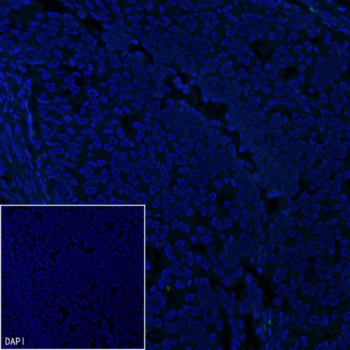Brachyury Recombinant Rabbit mAb (SDT-1926-107)
