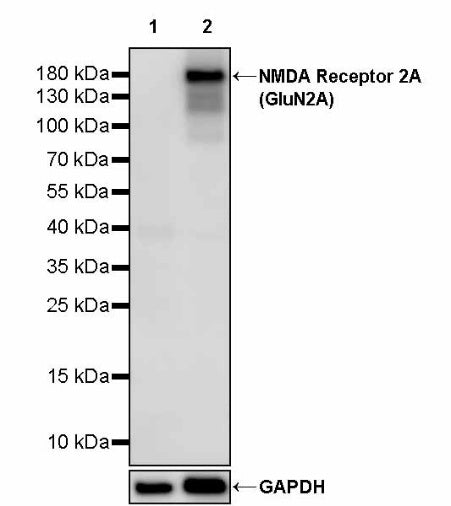 NMDA Receptor 2A (GluN2A) Recombinant Rabbit mAb (S-2126-168)