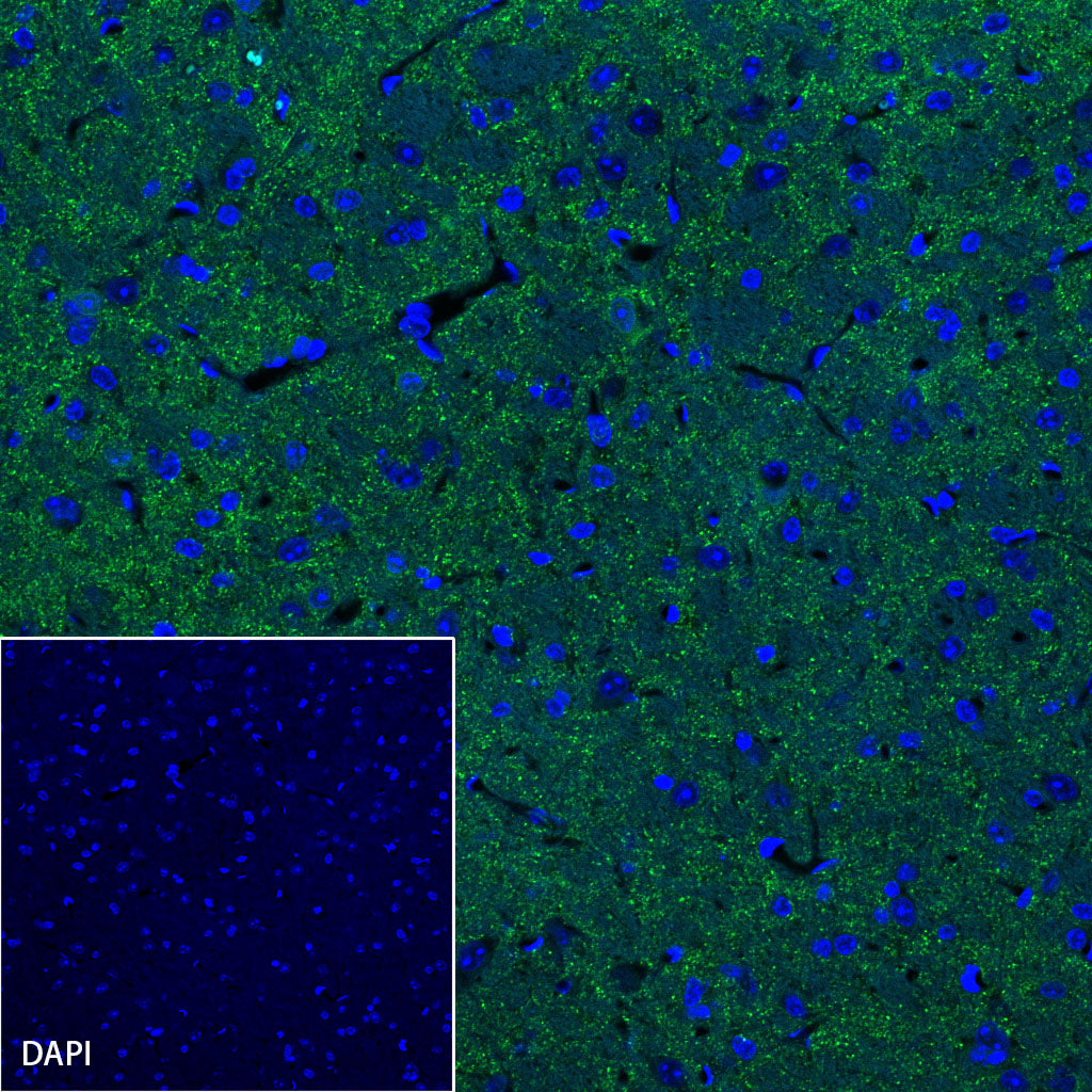 α-Synuclein Recombinant Rabbit mAb (S-441-86)