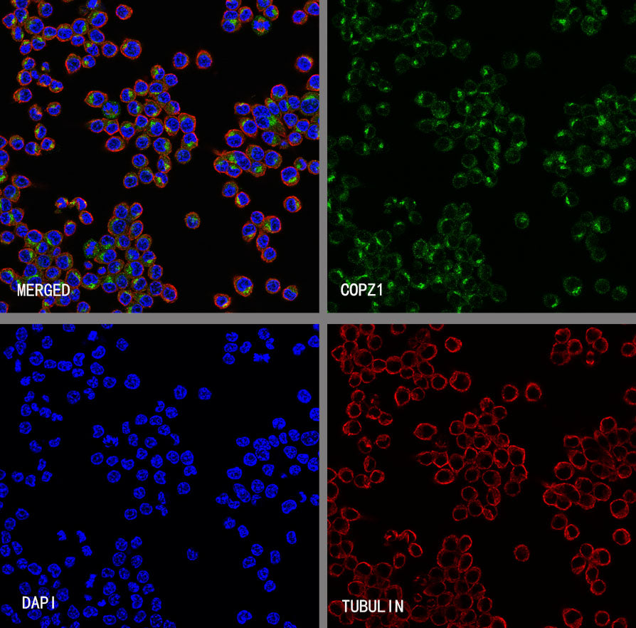 COPZ1 Recombinant Rabbit mAb (S-4445-53)