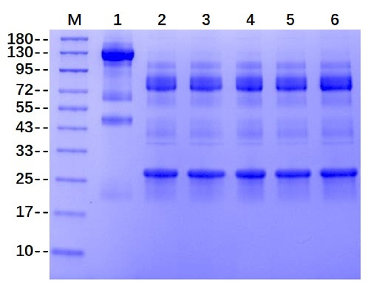 IdeS Protease