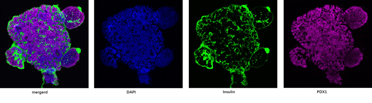KGF/FGF-7 Protein, Human