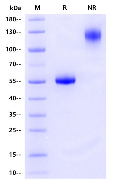 Human CD8 alpha&beta (CD8A&CD8B) Heterodimer Protein, hFc Tag